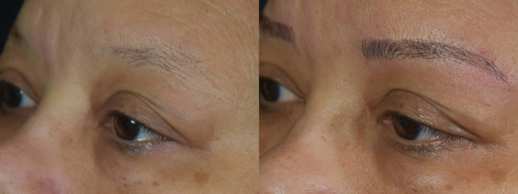 Microblading Before and After Photo by Versailles Medical Spa in Darien, CT