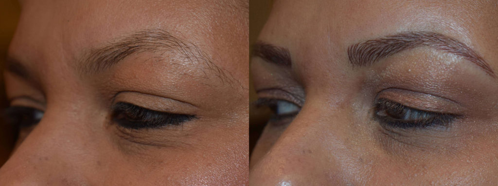 Microblading Before and After Photo by Versailles Medical Spa in Darien, CT