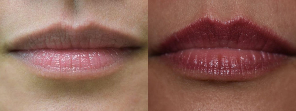 Permanent Makeup Before and After Photo by Versailles Medical Spa in Darien, CT